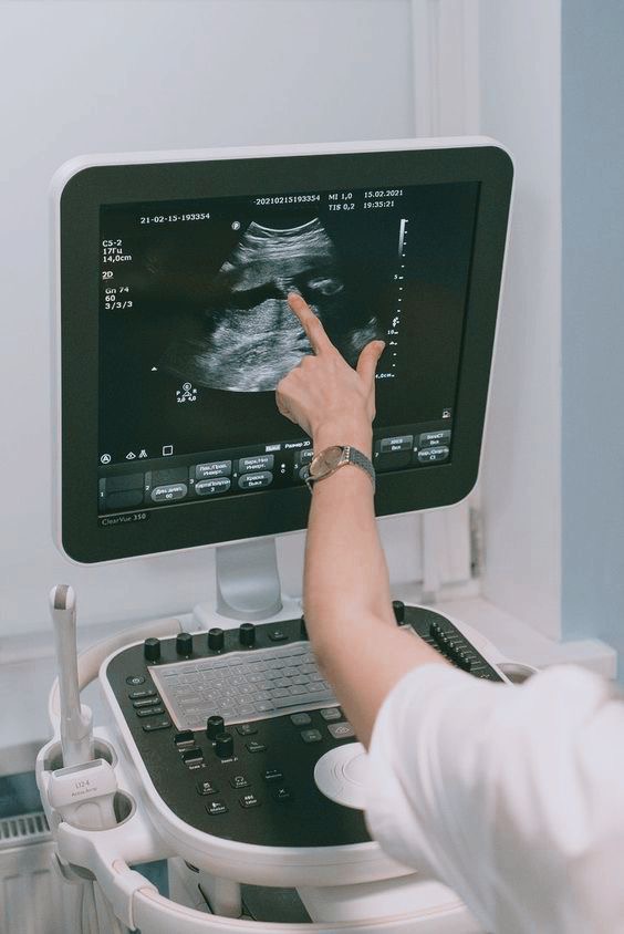 УЗИ при беременности