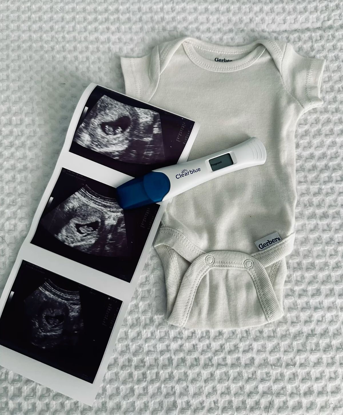 Почему не получается забеременеть: роль гинеколога и точной диагностики