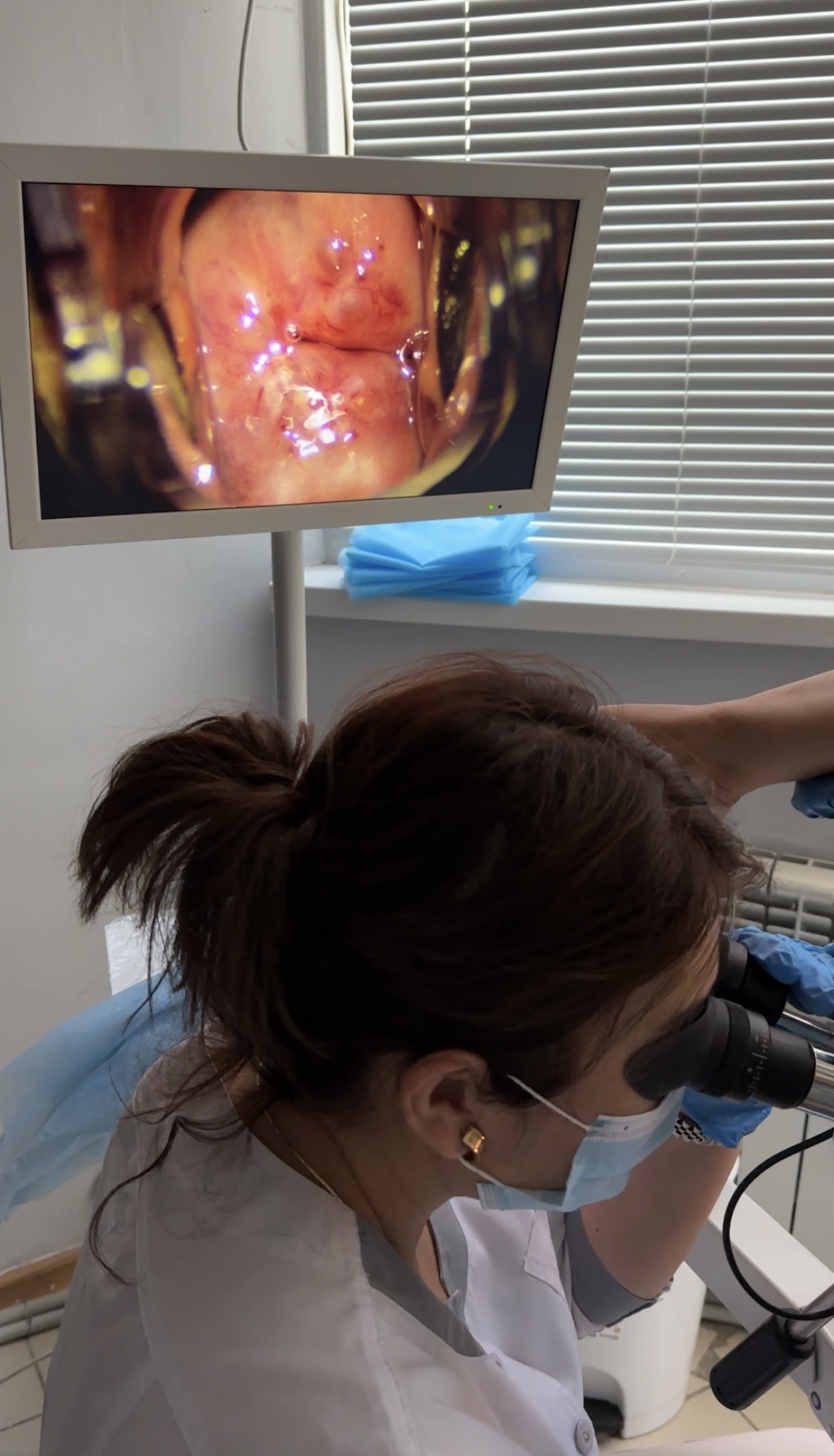 Кольпоскопия